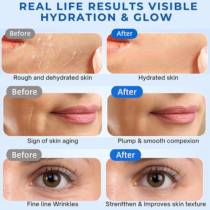 Vials of 3% Hyaluronic acid hydrating serum for face