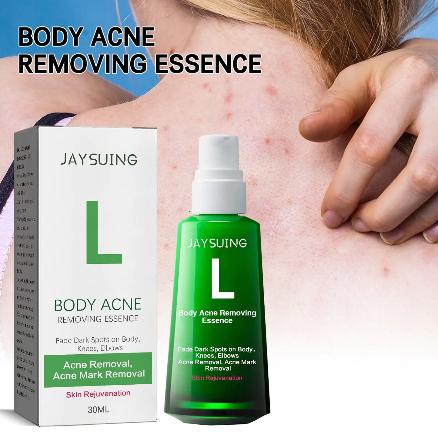 BODY ACNE REMOVING ESSENCE