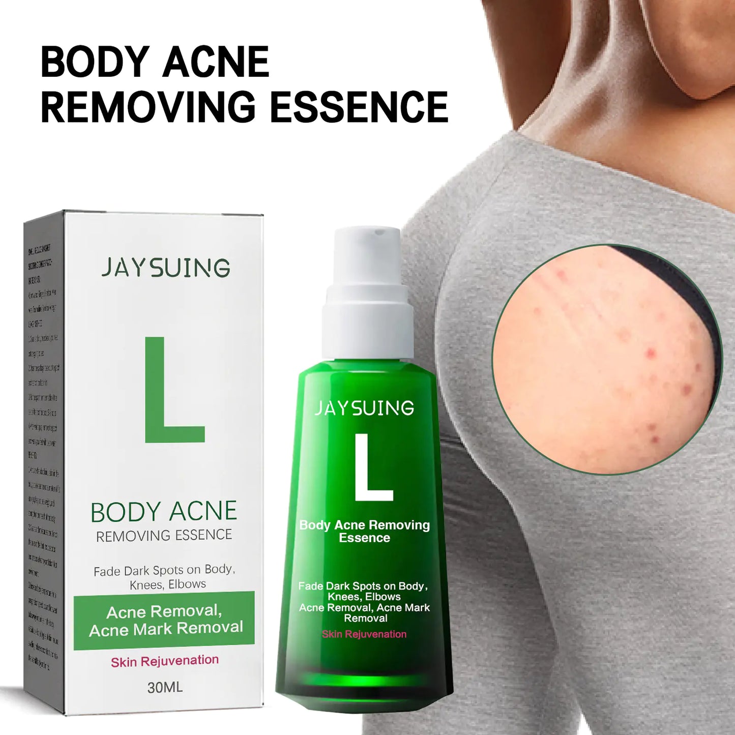 BODY ACNE REMOVING ESSENCE
